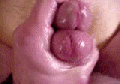 stroke